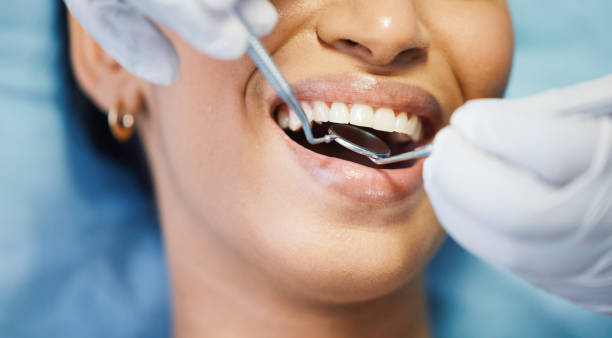 Best Emergency Dentist for Lost Fillings or Crowns in Xenia, OH